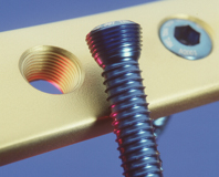 骨骼鎖定鋼板的輪廓度檢測(圖2) 骨骼鎖定鋼板的輪廓度檢測(圖2)